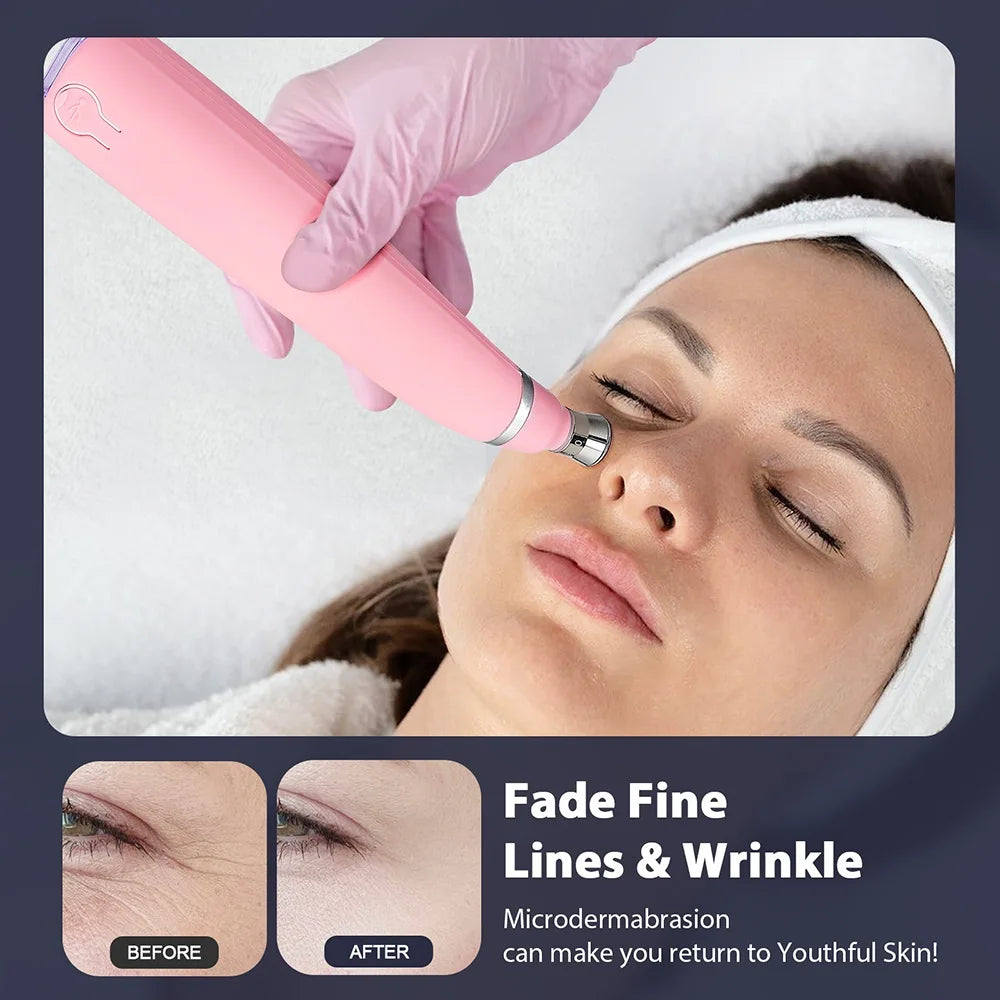 Portable Facial Exfoliation & Pore Cleaner