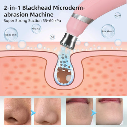 Portable Facial Exfoliation & Pore Cleaner