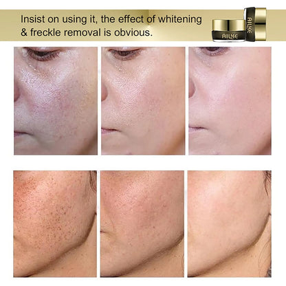 Whitening And Removing Face Freckle Cream
